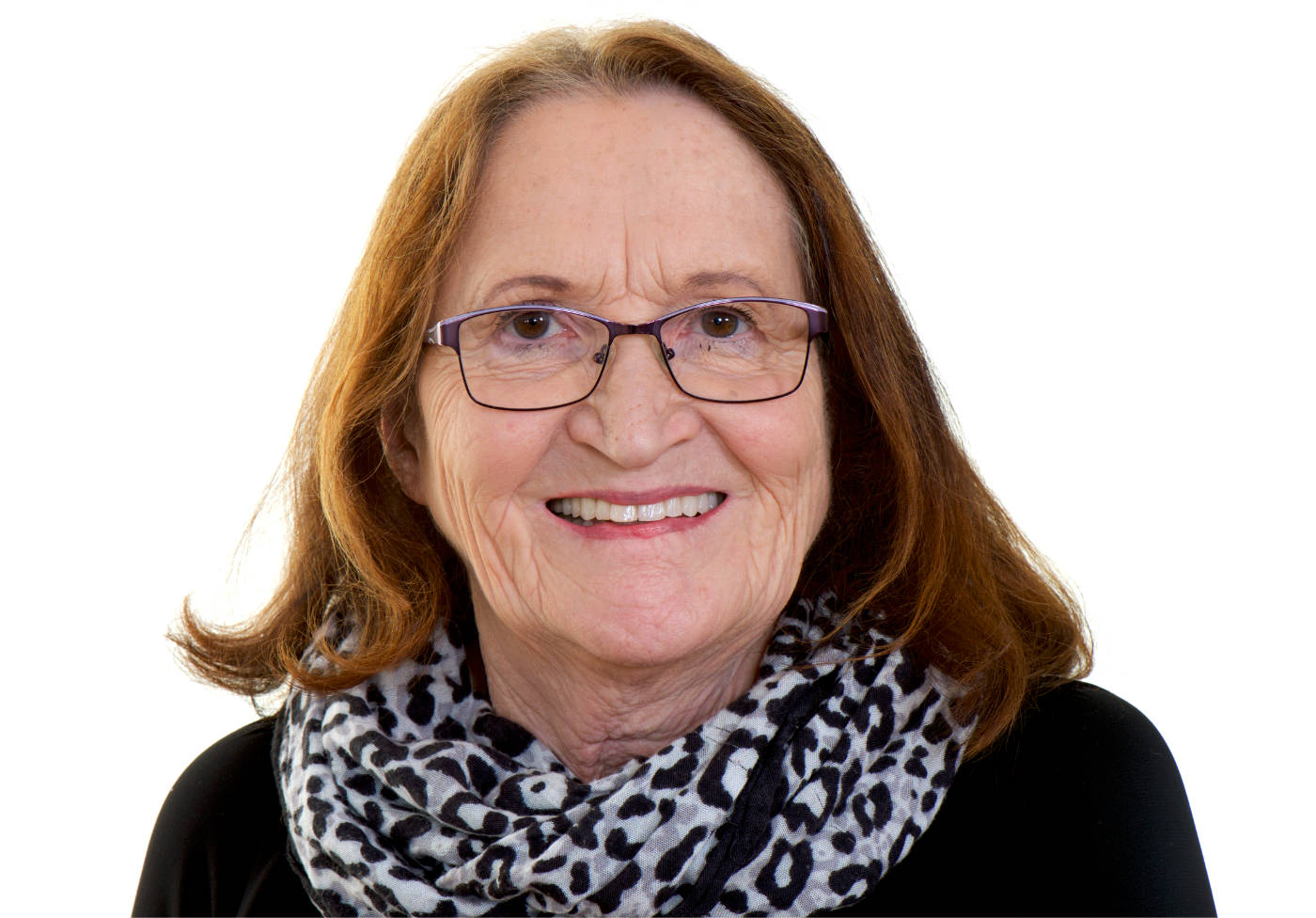 Behandlungsergebnis, perfekte Lippenunterstützung und Ästhetik der Frontzähne