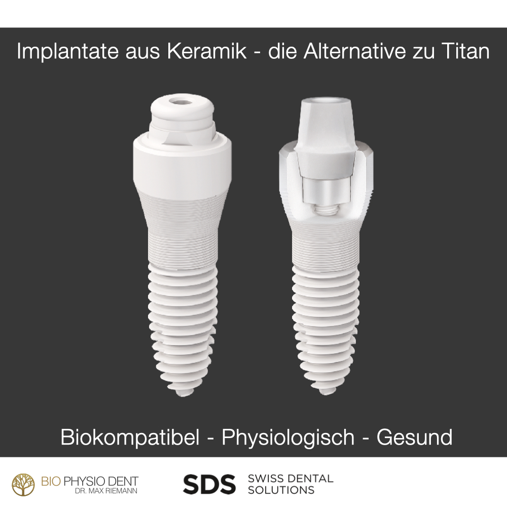 Keramikimplantate Zahn Riemann Biophysiodent