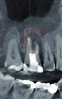 Kunststoffe-und-Mikroplastik-01