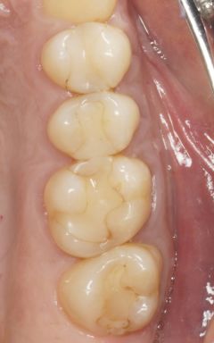 Kunststoffe-und-Mikroplastik-01