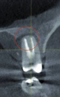 Kunststoffe-und-Mikroplastik-01