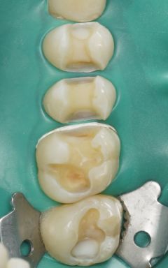 Kunststoffe-und-Mikroplastik-01