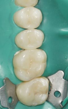 Kunststoffe-und-Mikroplastik-01